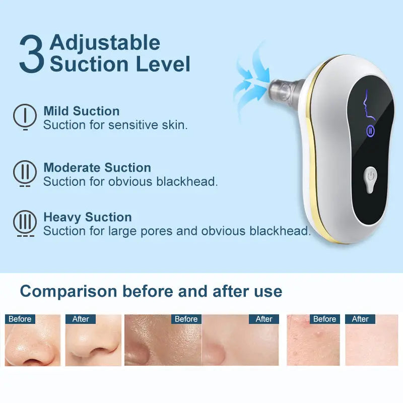 Ultrasonic Pore Cleanser with Electric Suction Zyvraxen