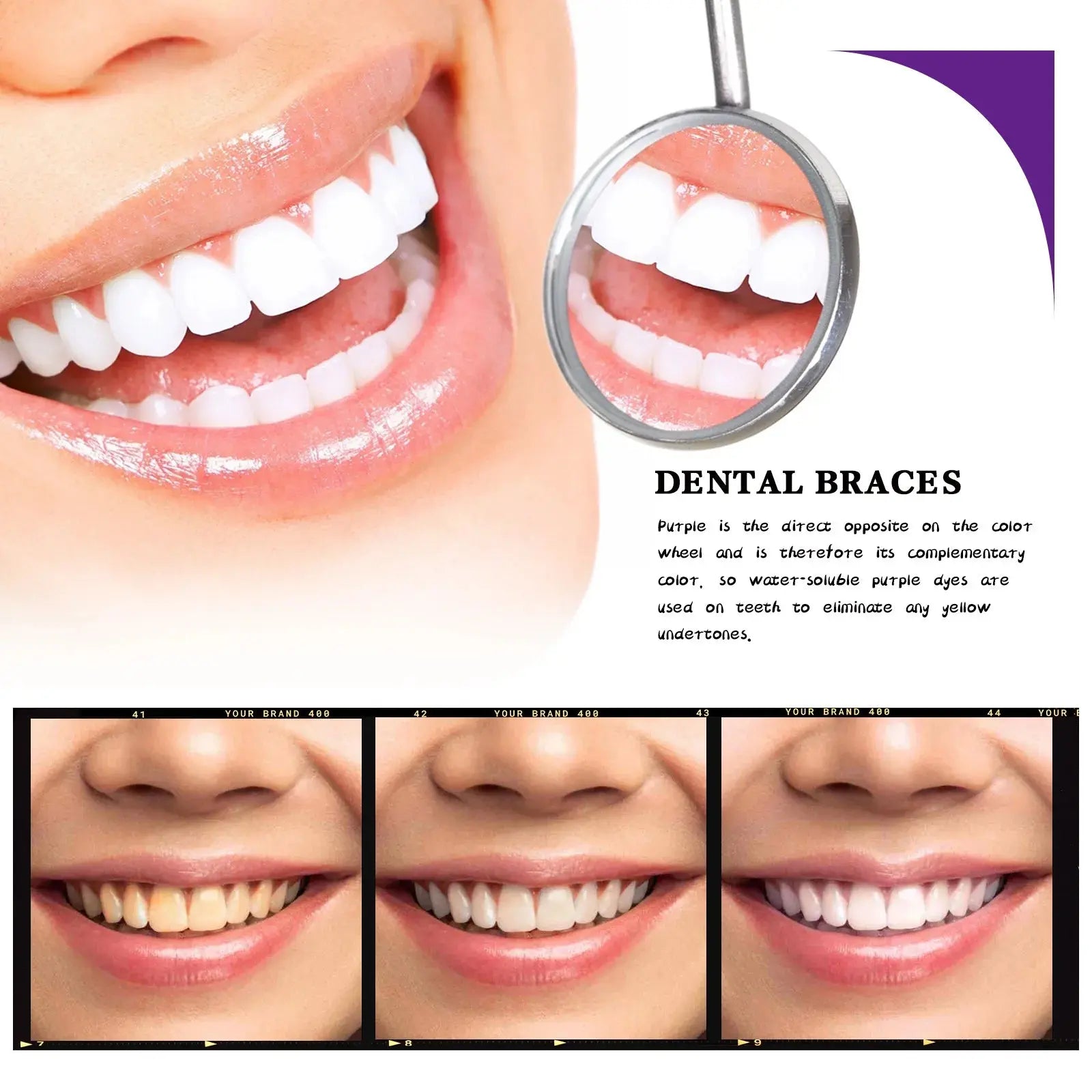 V34 Tooth Cleaning Mousse Moretech