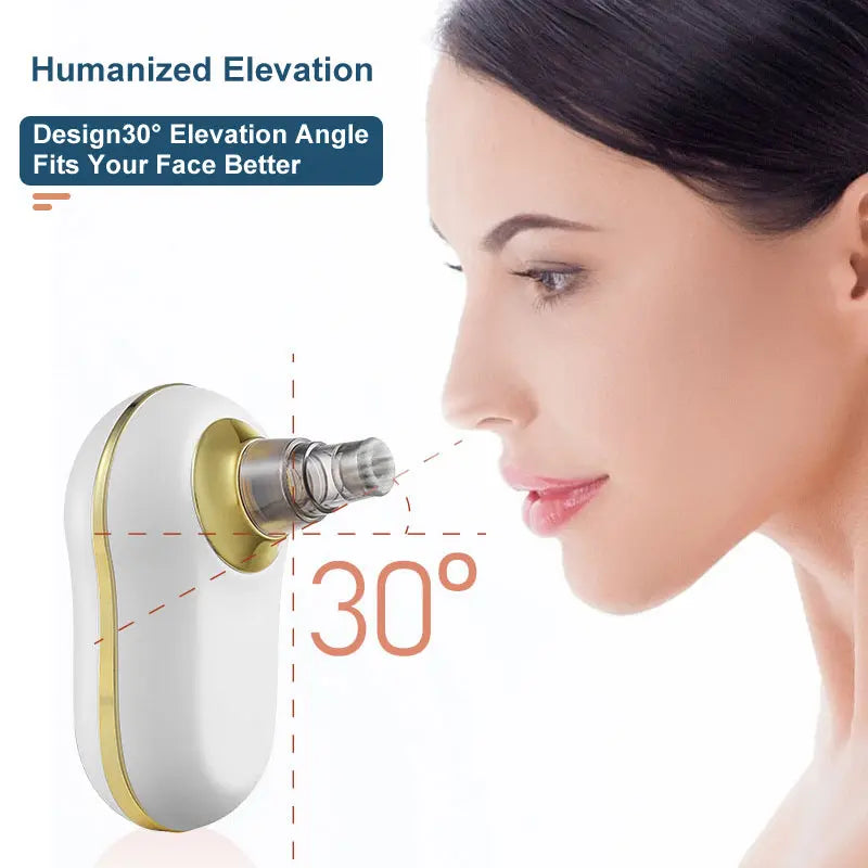 Ultrasonic Pore Cleanser with Electric Suction Zyvraxen