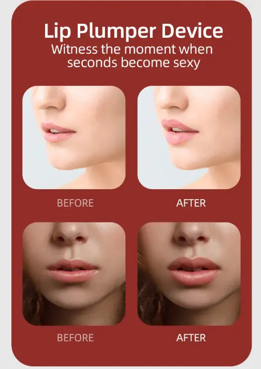 Silicone Lip Augmentor zyvraxen