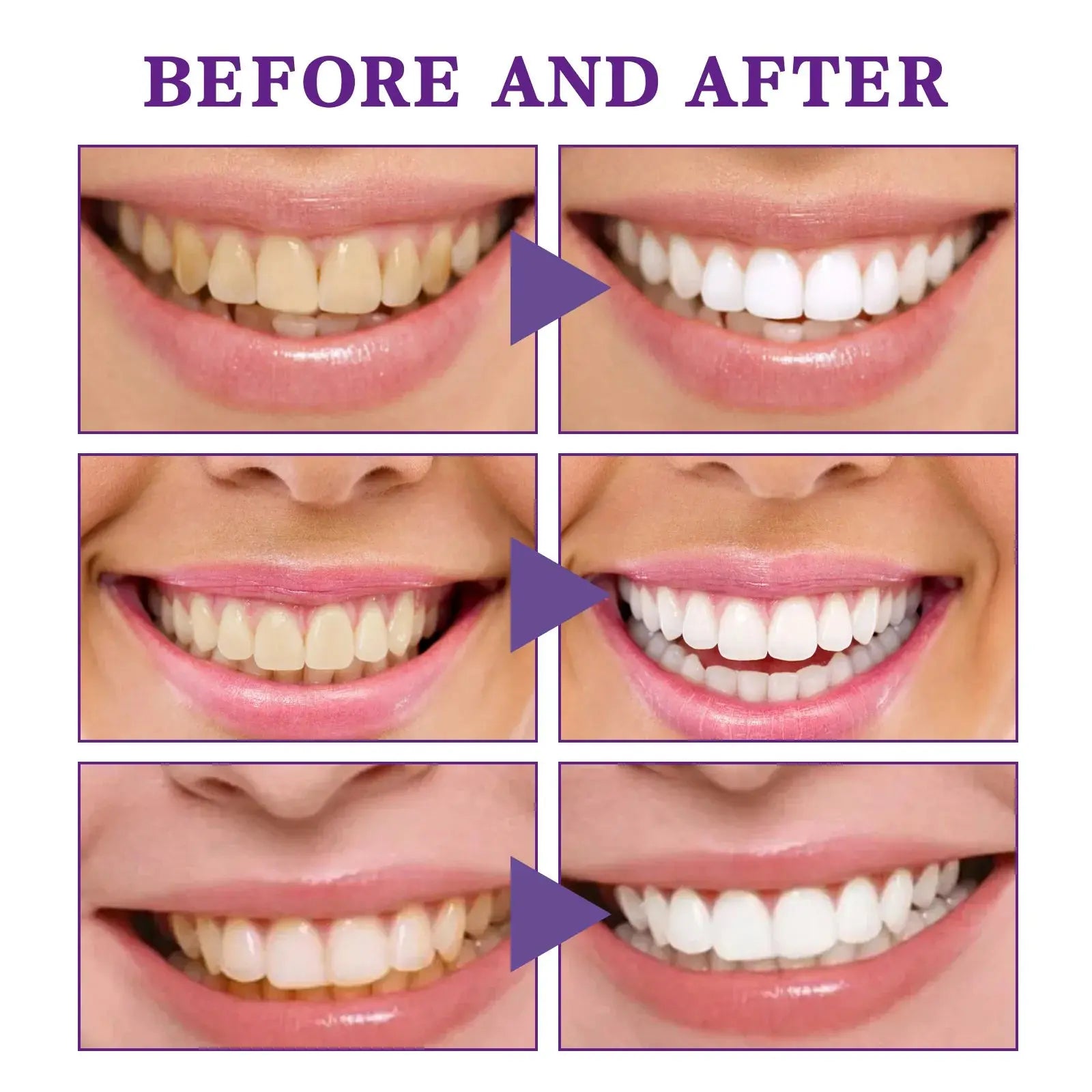 V34 Tooth Cleaning Mousse Moretech