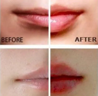 Miracle Lip Plumper Moretech