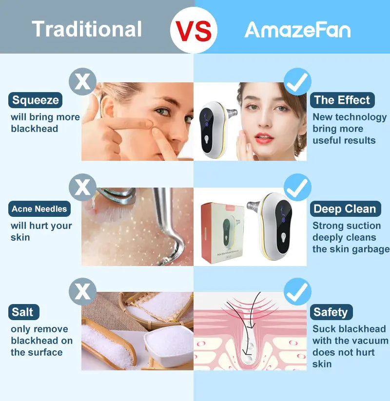 Ultrasonic Pore Cleanser with Electric Suction Zyvraxen